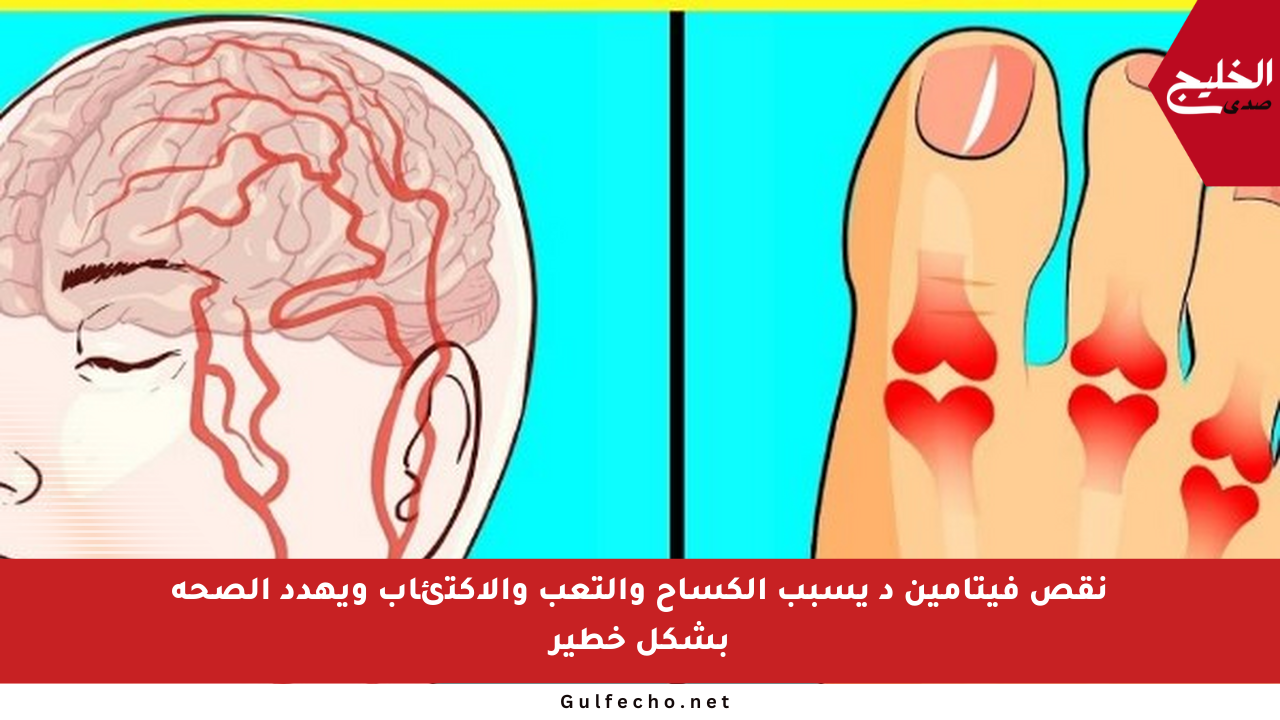 نقص فيتامين د يسبب الكساح والتعب والاكتئاب ويهدد الصحة بشكل خطير